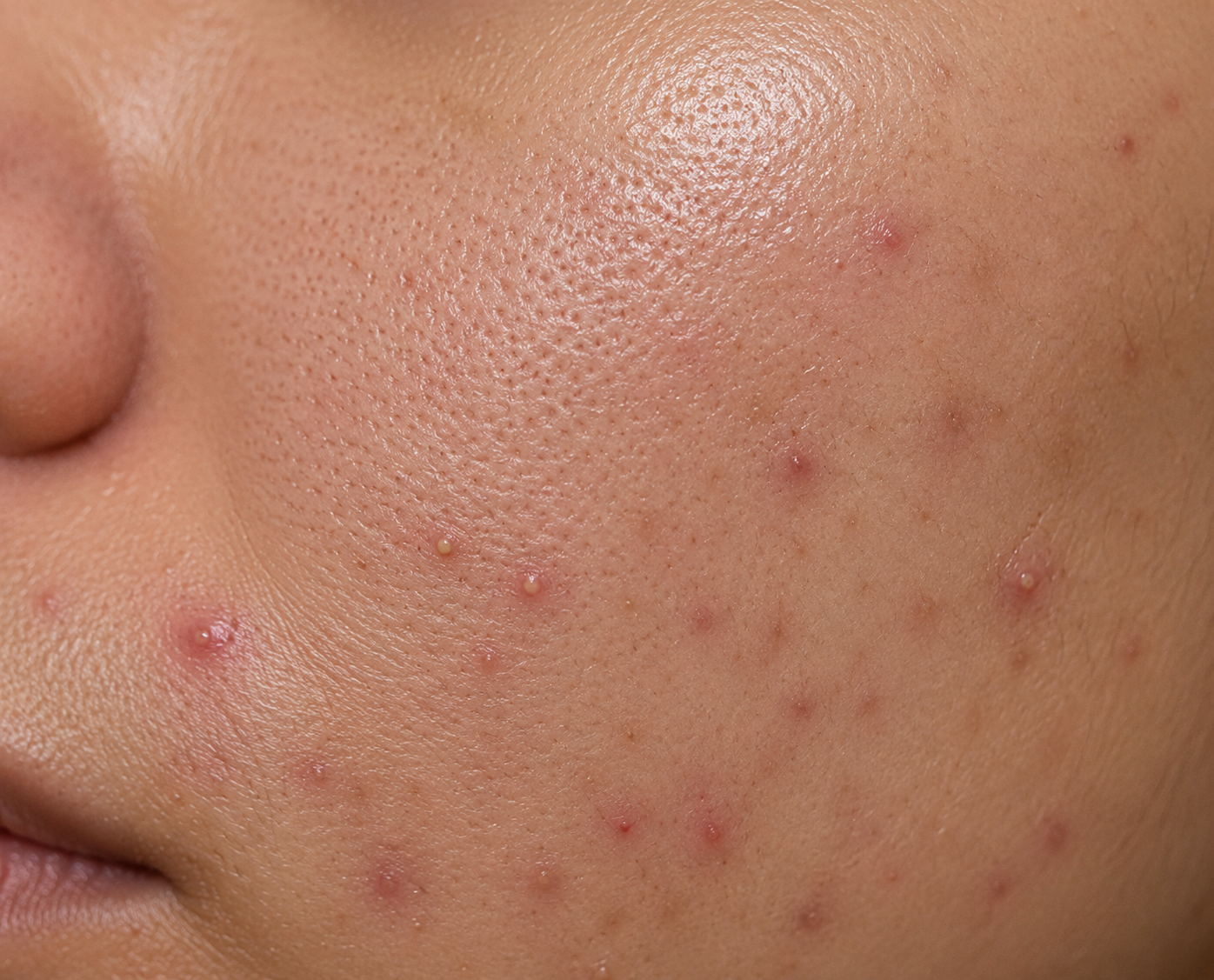 Redness Relief Cream & Serums