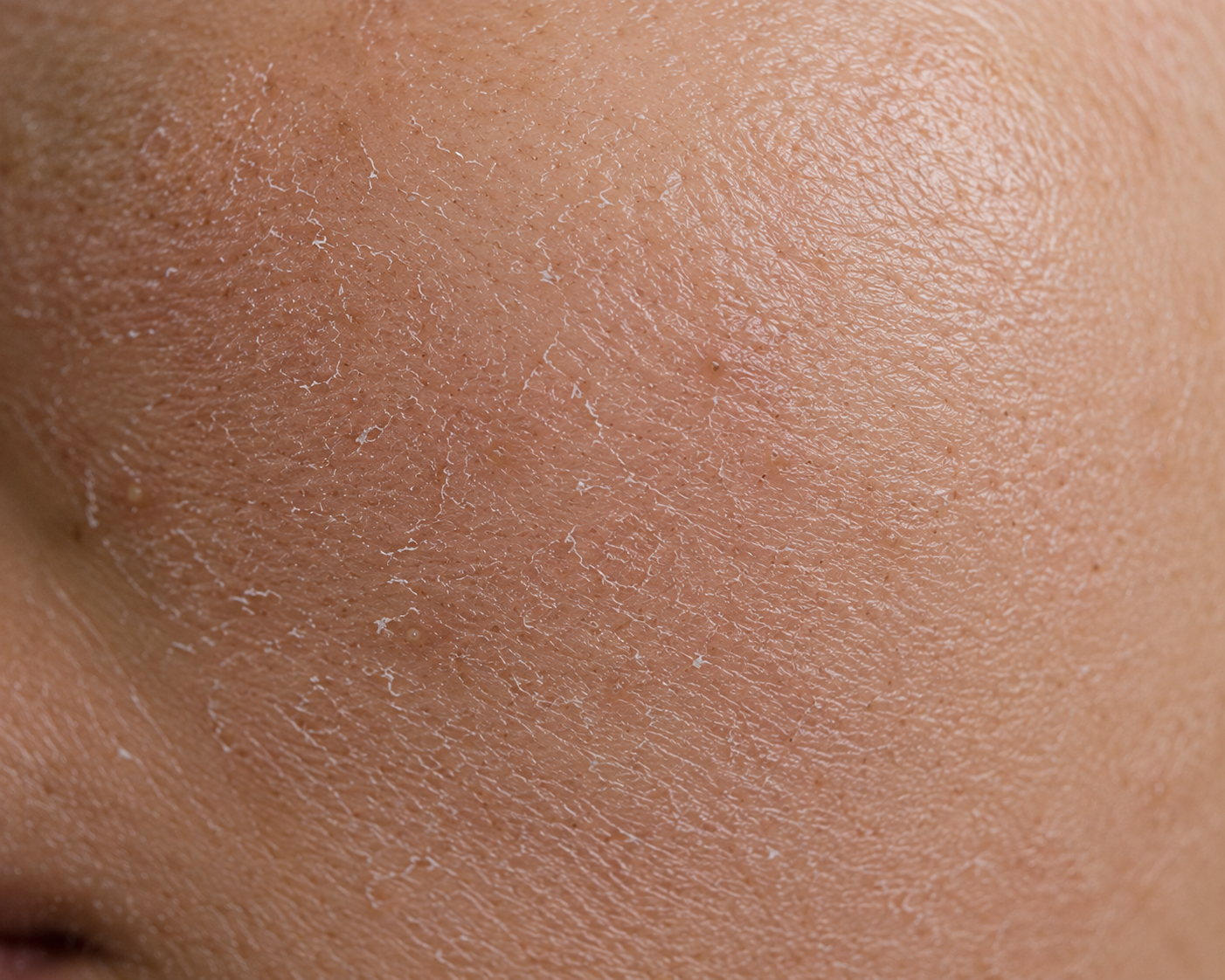 Dry & Dull Skin Solutions