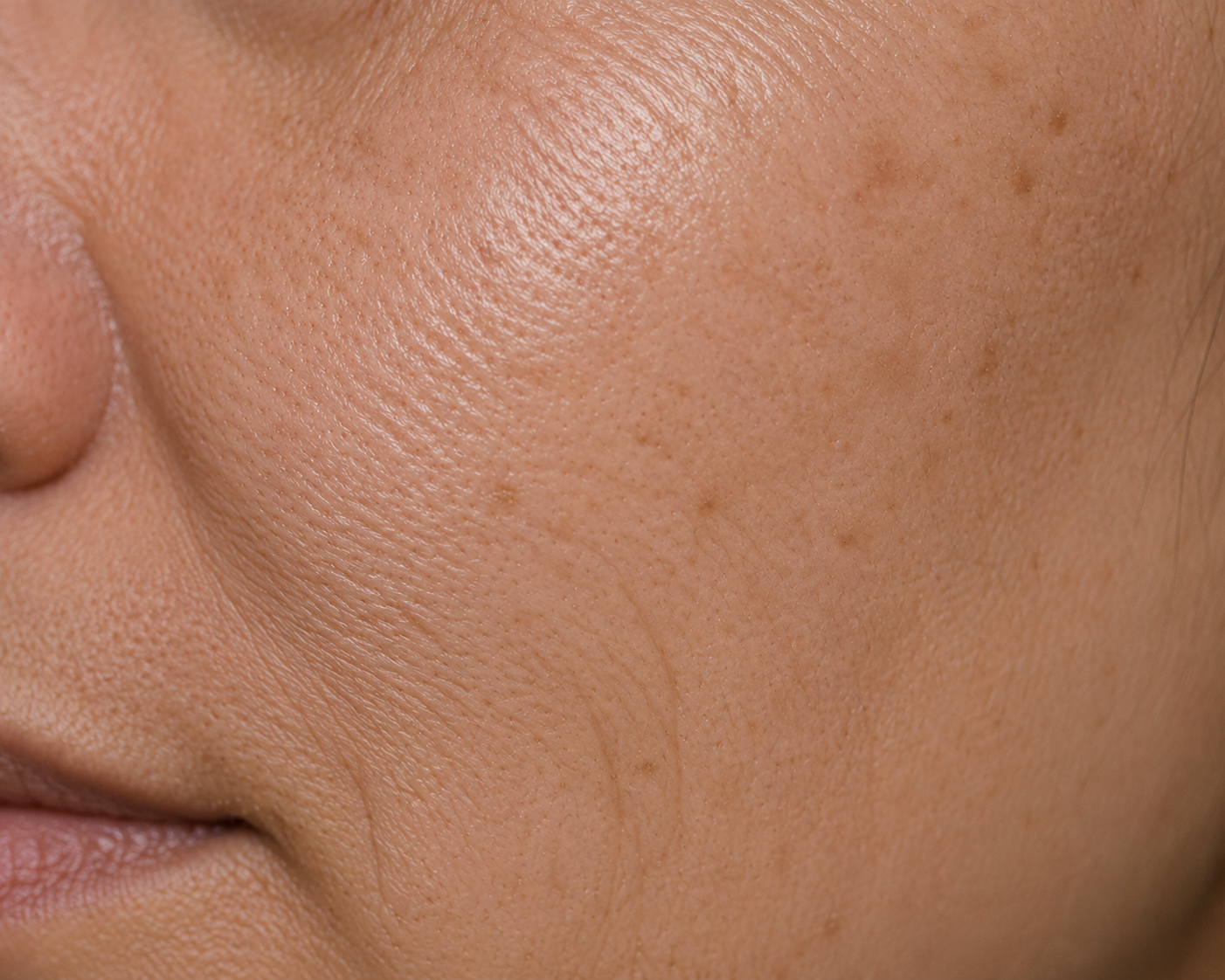 Fine Lines & Wrinkles