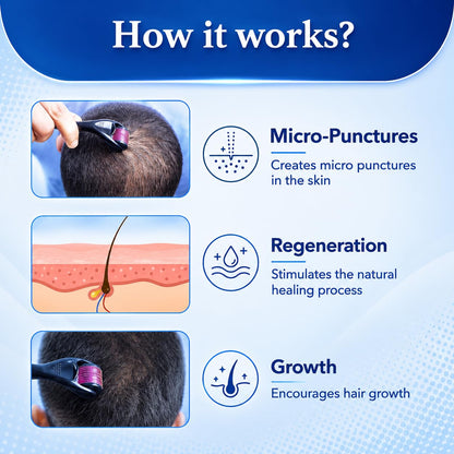 Derma Roller 0.5mm for Hair Growth & Beard Care | 540 Titanium Microneedles Scalp Roller