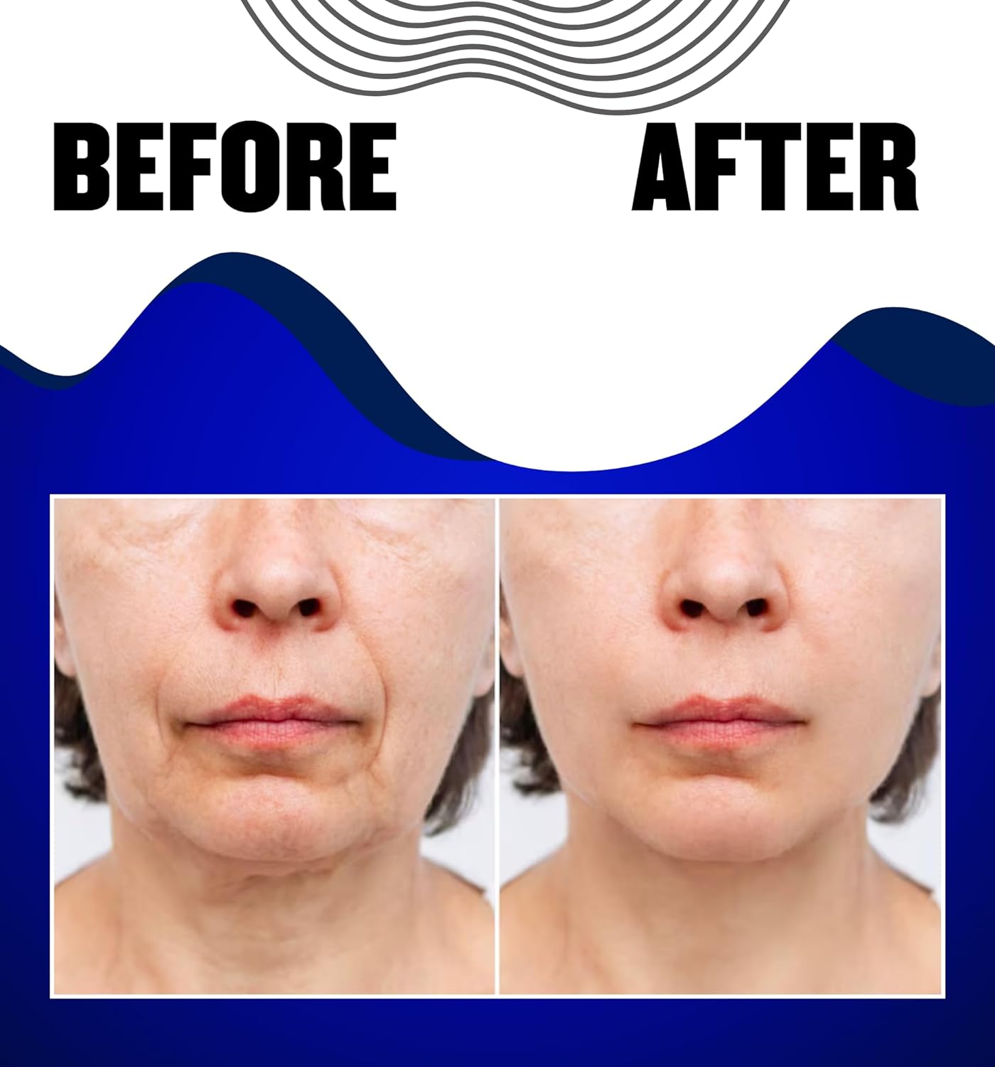 Retinol & Peptide Face Serum (33 ml / 1.12 oz): Fight Signs of Aging, Even Skin Tone, Improve Elasticity & Reveal a Firmer, Glowing Appearance Naturally
