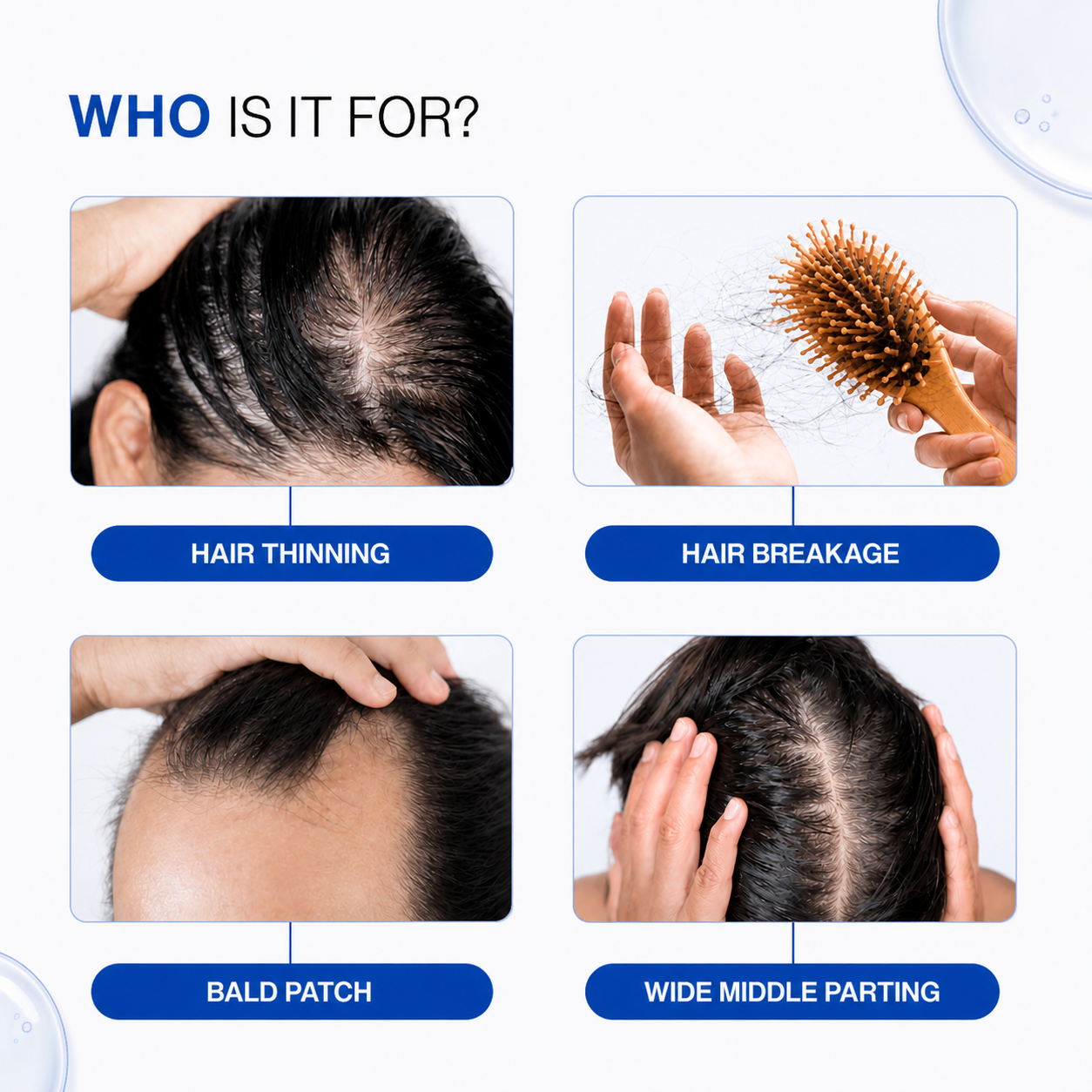 Advanced Hair Growth Serum With Derma Roller 0.5 mm