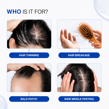 Advanced Hair Growth Serum With Derma Roller 0.5 mm