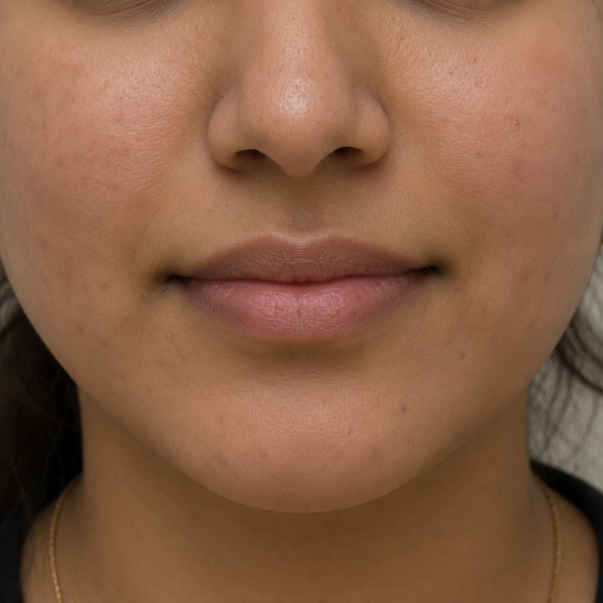 Before using the product