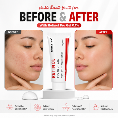 Retinol Pro Gel 0.1%