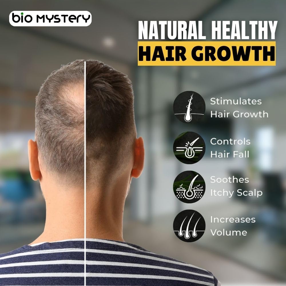 Bio Mystery Hair Growth Serum with Redensyl, Anagain, Baicapil & Capilia Longa – Boost Hair Growth & Reduce Hair Fall – 60ml / 2.02 fl oz